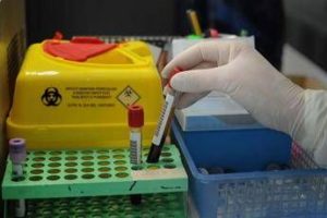 tumori nuovo test del sangue low cost promette di scoprire diversi tipi di cancro 2