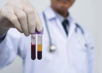 farmaceutica gardini genomeup ai per programmare terapie con plasmaderivati 2