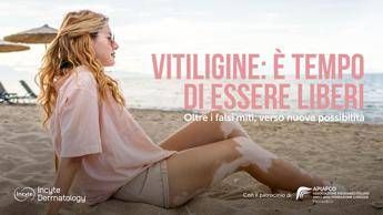 salute giornata vitiligine al via campagna oltre falsi miti verso nuove possibilita 2