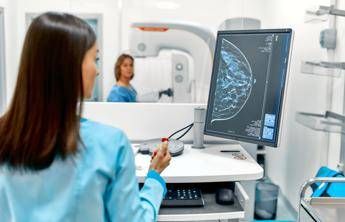 screening mammografico prevenzione negata a oltre 2 mln di donne 2