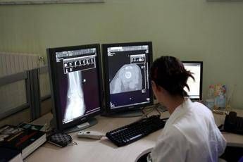un italiano su 4 e over 65 sirm prevenzione personalizzata con radiologia geriatrica 2