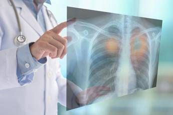 fine vita oncologi no a comitato nazionale e a esclusione ssn subito confronto 2
