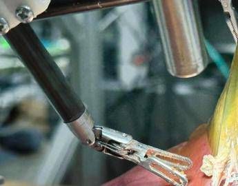 il dottor robot opera da solo primo intervento senza aiuto umano 2