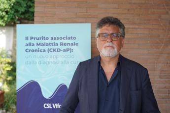 nefrologi successo in 85 casi per cura contro prurito in malattia renale cronica 2