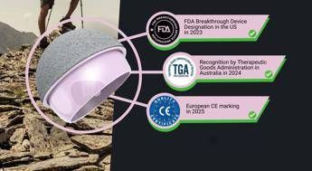 nuova era per le protesi danca il chirurgo calistri con ceramica biocompatibile piu osso risparmiato 2