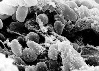 ricerca scorrano tor vergata dal dna di 1 313 antenati levoluzione delle malattie infettive 2