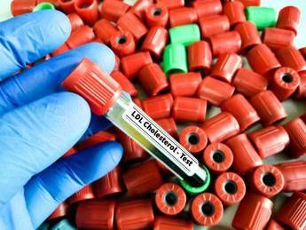 colesterolo ldl per abbassalo in sviluppo nuova terapia con tripla combinazione 2