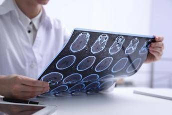 giornata sla neurologi non resti confinata alla sperimentazione 2
