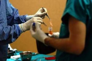 trapianti a modena il primo in europa di fegato da donatore vivente con robot 2