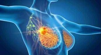 cancro seno iniziale her2 con anticorpo farmaco coniugato 53 recidiva 2