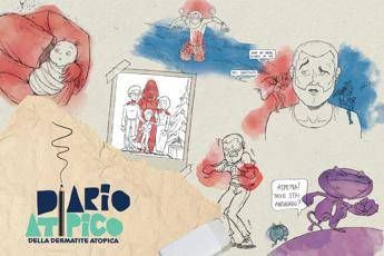 dermatite atopica oltre 13 mln di persone hanno visto il corto diario atipico 2