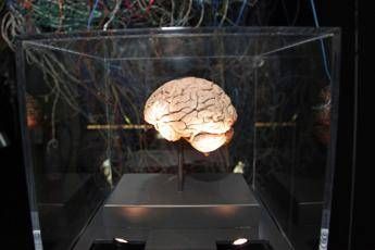 medicina neurologi linnovazione puo cambiare la storia di molte malattie ma serve equita 2