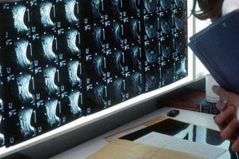 oltre 500 malattie rare delle ossa esperti investire in prevenzione e diagnosi 2