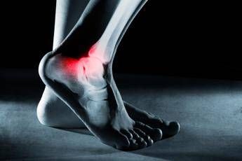 ossa fragili dei calciatori ecco perche post ritiro tanti soffrono di osteoartrite 2