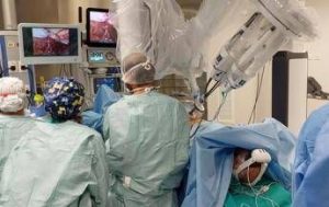 torino rimosso cancro prostata con robot e incisione di soli 35 cm sul paziente sveglio 2