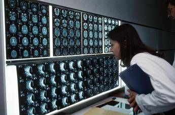 cancro 4 sintomi insoliti che bisogna conoscere parola di oncologo 2