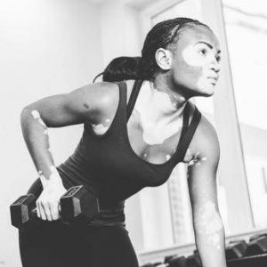 e la vitiligine week cosi la terapia della luce aiuta il farmaco 2