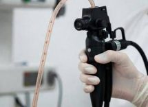 esofagite eosinofila scambiata per depressione cose e come riconoscerla 2