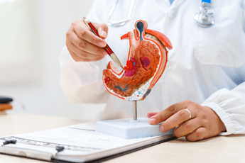 tumore allo stomaco pazienti diagnosi precoce per meno di 1 su 5 migliorare percorsi 2