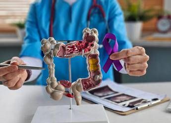 tumori del colon retto int milano in progetto ue che punta a prevedere efficacia immunoterapia 2