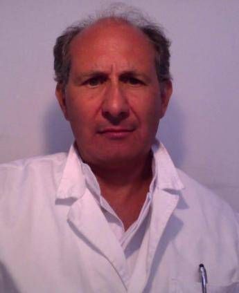 faccia a luna piena e pelle sottile e la sindrome di cushing cose e come si cura 2