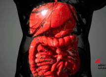 malattia di crohn solo 1 paziente su 3 riceve supporto nutrizionale 2