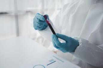 epatite a in forte crescita in italia lazio campania e puglia le regioni con piu casi 2