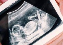 gravidanza arrivano le nuove linee guida delliss ecco quando fare e quando non fare lecografia e altri esami 5
