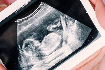 gravidanza arrivano le nuove linee guida delliss ecco quando fare e quando non fare lecografia e altri esami 5