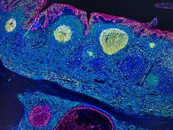 irccs pascale napoli mappa gps delle cellule rivoluziona limmunoterapia 2