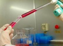 melanoma uveale metastatico tebentafusp raddoppia sopravvivenza a 5 anni 2