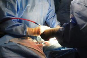 operata al femore a 104 anni gia in piedi il giorno successivo allintervento 2