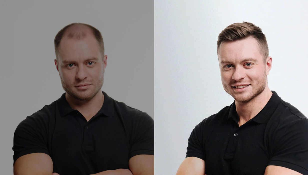 protesi capelli uomo lordhair italia