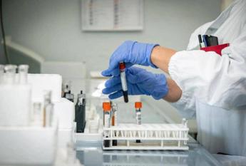 alzheimer nuovo test del sangue potrebbe prevedere sintomi imminenti 2