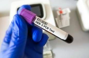 tumore gastroesofageo her2 risultati positivi per tislelizumab con zanidatamab e chemio 2