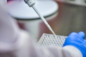 giornata mondiale della malattia di sjogren esperti non sono solo occhi secchi 2